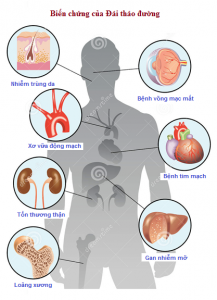 NHỮNG NGUYÊN TẮC DINH DƯỠNG CƠ BẢN CẦN LƯU Ý CHO NGƯỜI BỆNH ĐÁI THÁO ĐƯỜNG