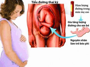 BỆNH TIỂU ĐƯỜNG Ở PHỤ NỮ MANG THAI – BIẾT SỚM, BỚT NGUY!