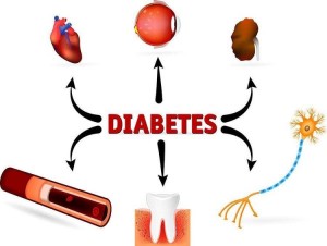 Chuột rút ở bệnh nhân đái tháo đường